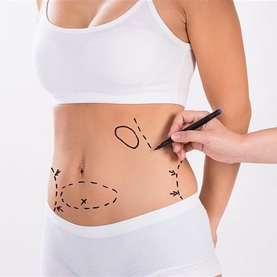 Body Jet Liposuction in Muscat