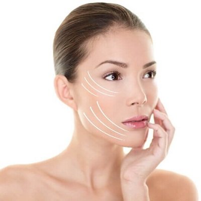 Facelift Surgery in Muscat - Rhytidectomy Oman